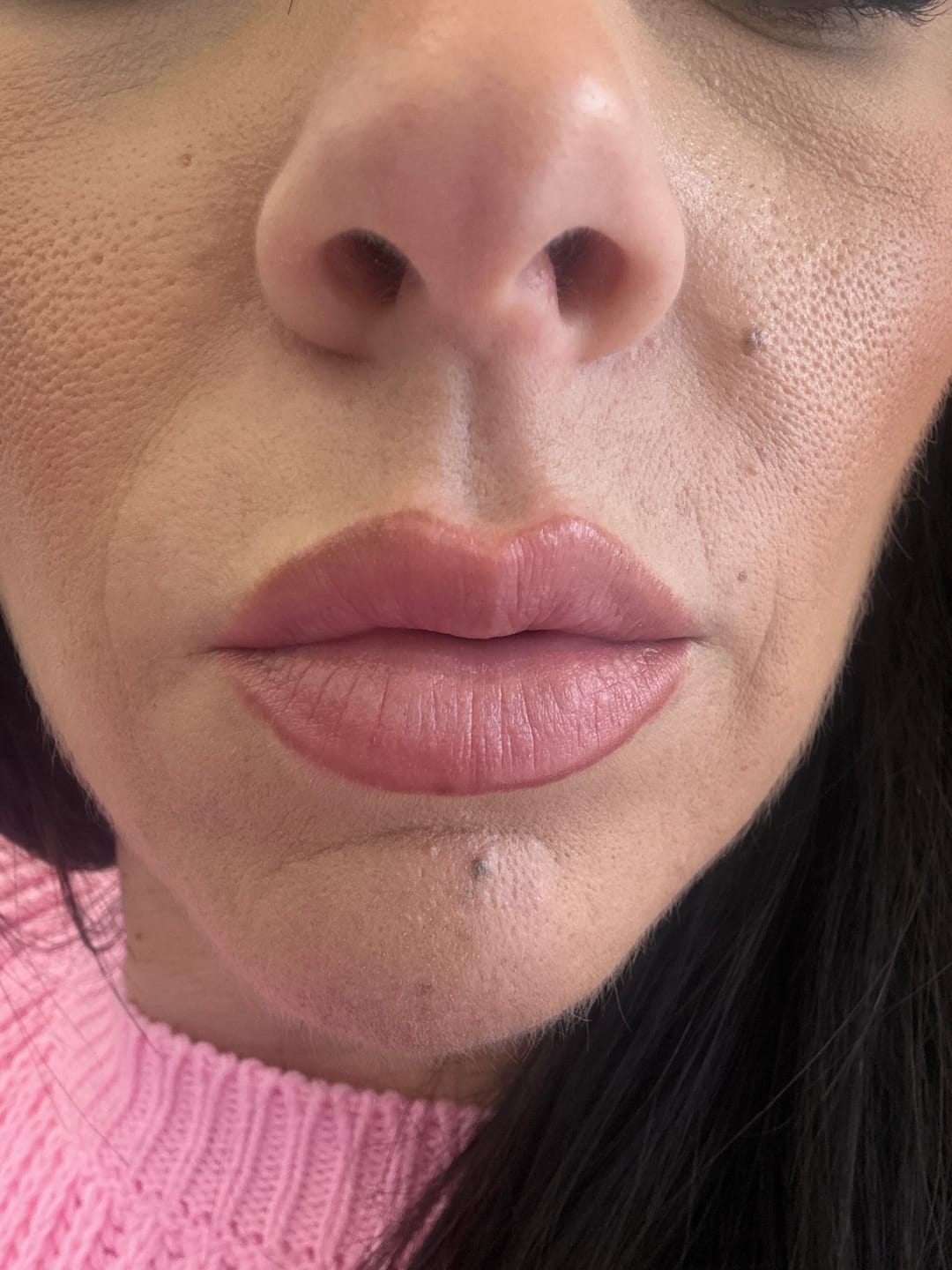 Customer photo review of Lip Contour