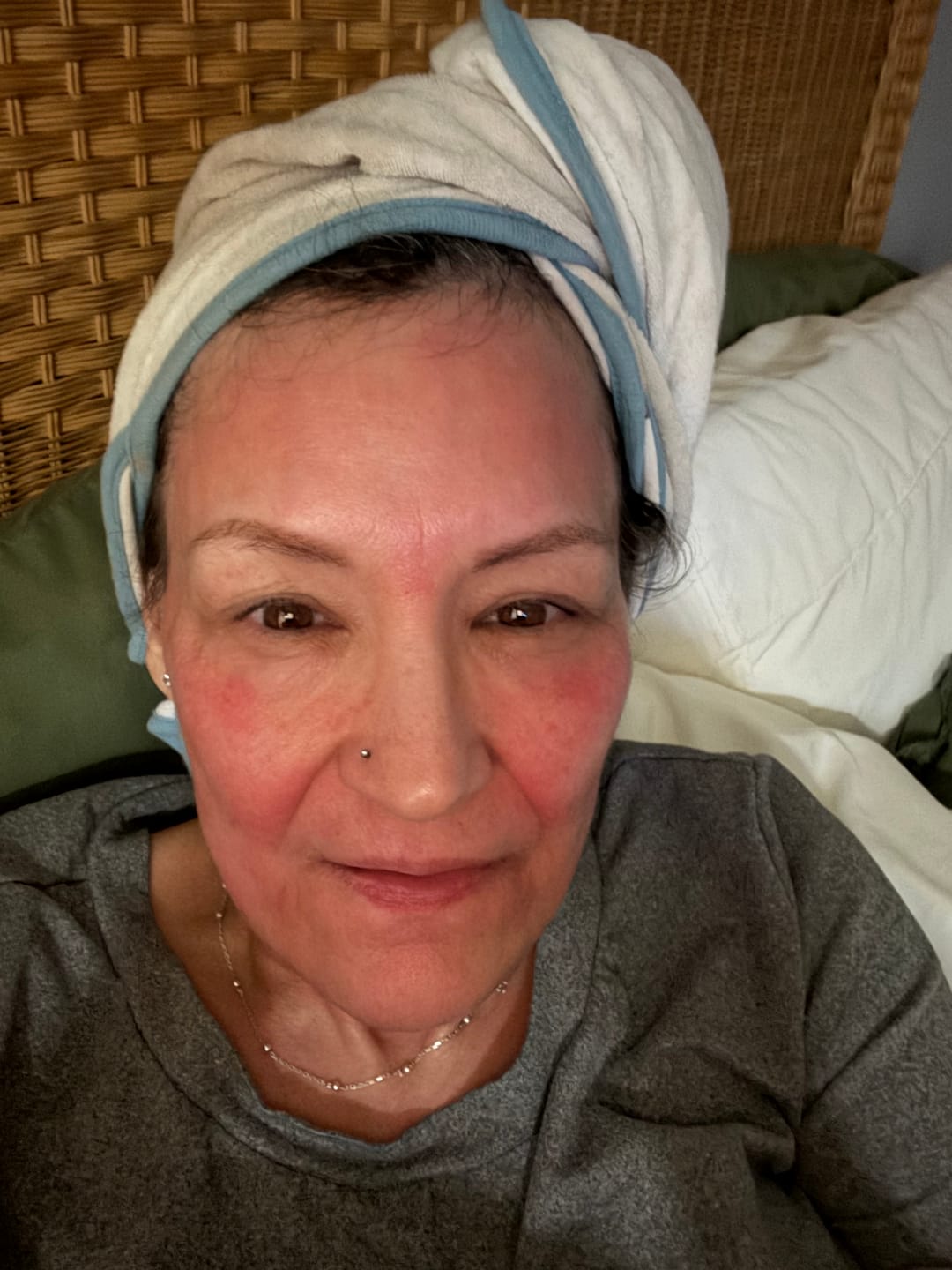 Customer photo review of Glov Micro Infusion System