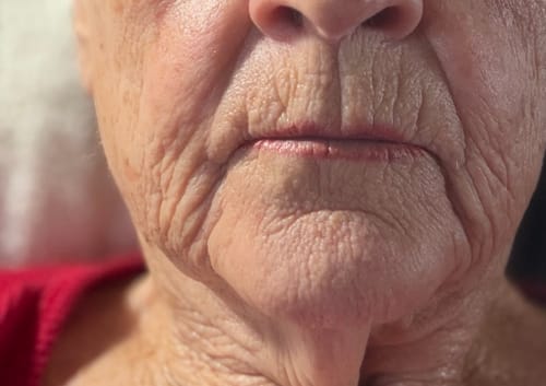 Close-up of a reviewer's face, showing deep wrinkles around the mouth and chin before using the Tallow & Honey Balm.