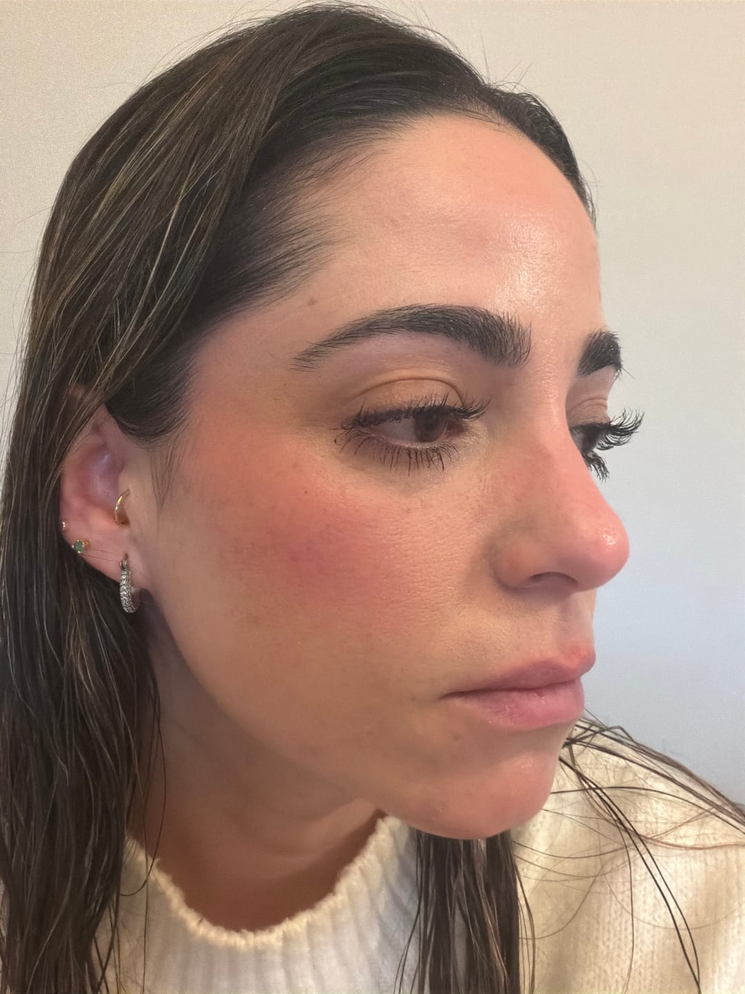 Customer photo review of Salicylic Acid Acne-Clearing 4-Piece Set
