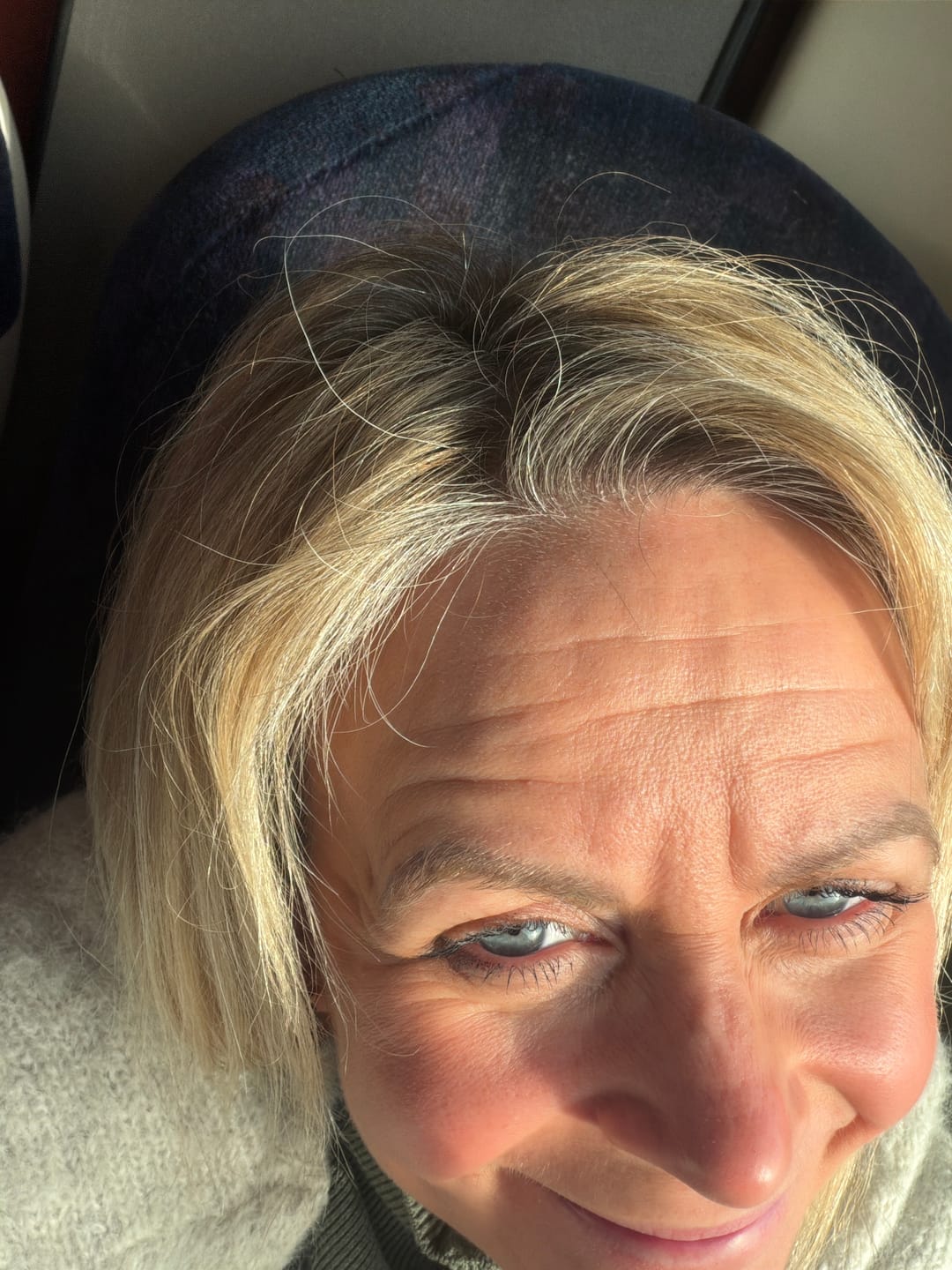 Customer photo review of Bye Bye Build Up - Scalp Exfoliator
