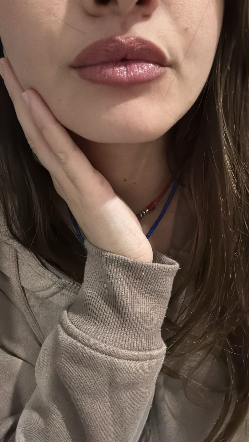 Customer photo review of Lip Contour
