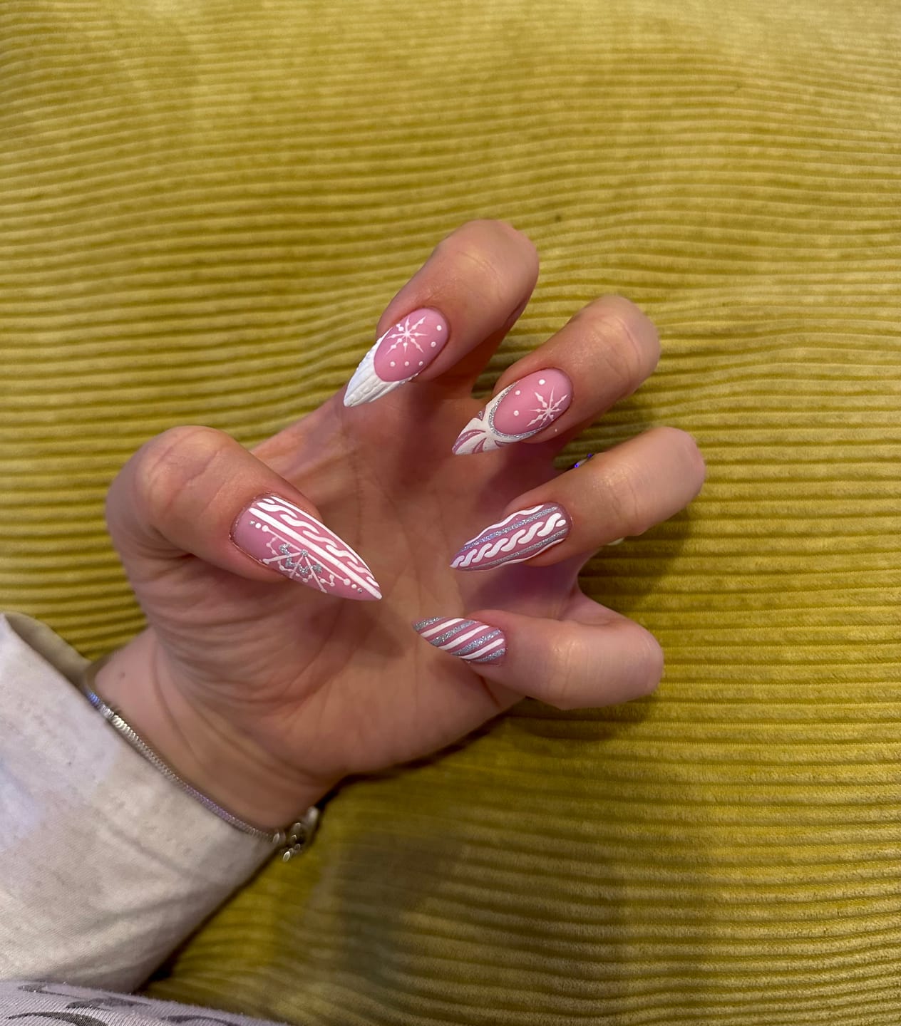 Customer photo review of Semilac White Decor Gel 5g