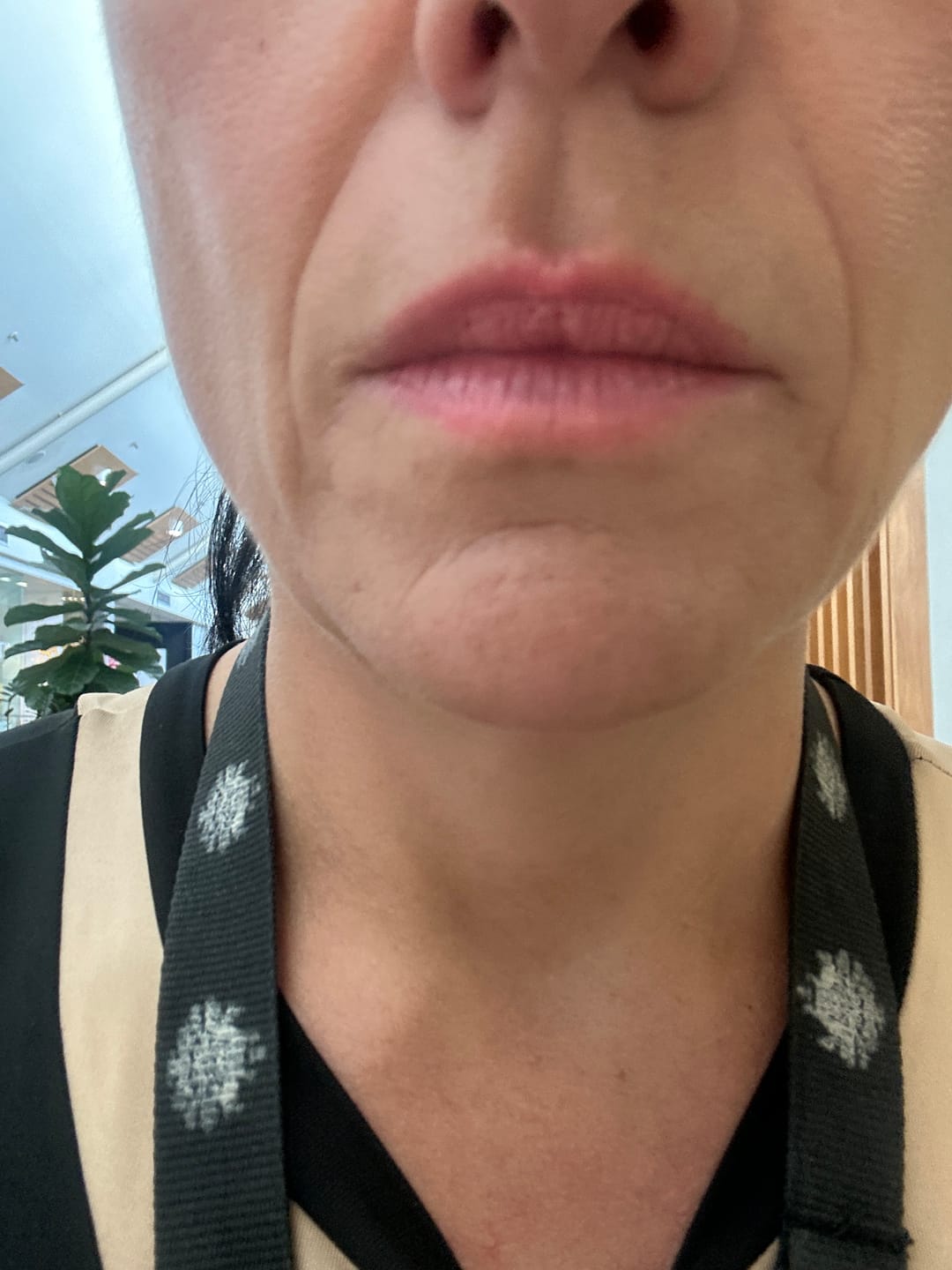 Customer photo review of The Naked Skin™ Collagen Overnight Wrapping Mask