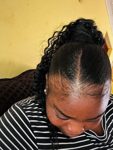 Customer photo review of Minoxidil DOUBLE ACTION Solution - MEN ONLY, 3x60ml pack