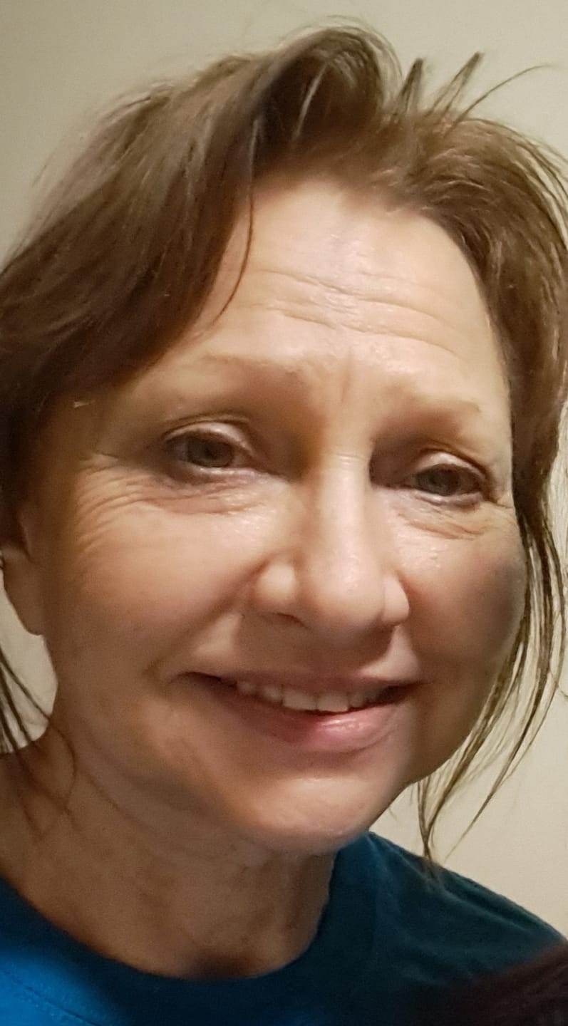 Customer photo review of 3-Pack Frankincense Restore & Renew Tallow Cream | FREE SHIPPING🚚