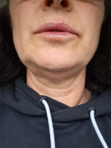 Customer photo review of COSTIQ® LONG LASTING LIP PLUMPER