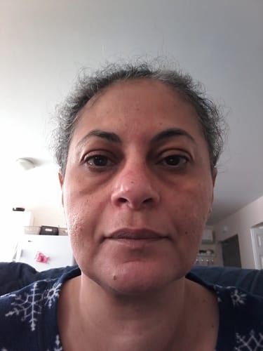 Customer photo review of Maple Energy Infusing Serum