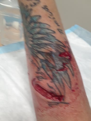 Customer photo review of Combat Ready Ointment - Big Tin