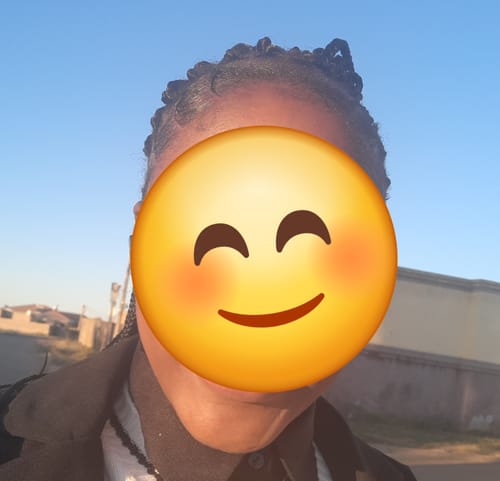 Customer photo review of Minoxidil High Strength (5%) SOLUTION, 3x60ml pack