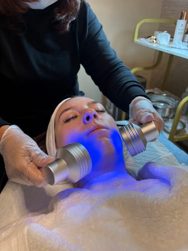Customer photo review of Rejuva Fresh Hydrafacial Solution 4pcs Set