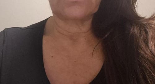 Customer photo review of Liftlab Face Sculpting Tool + Free Serum
