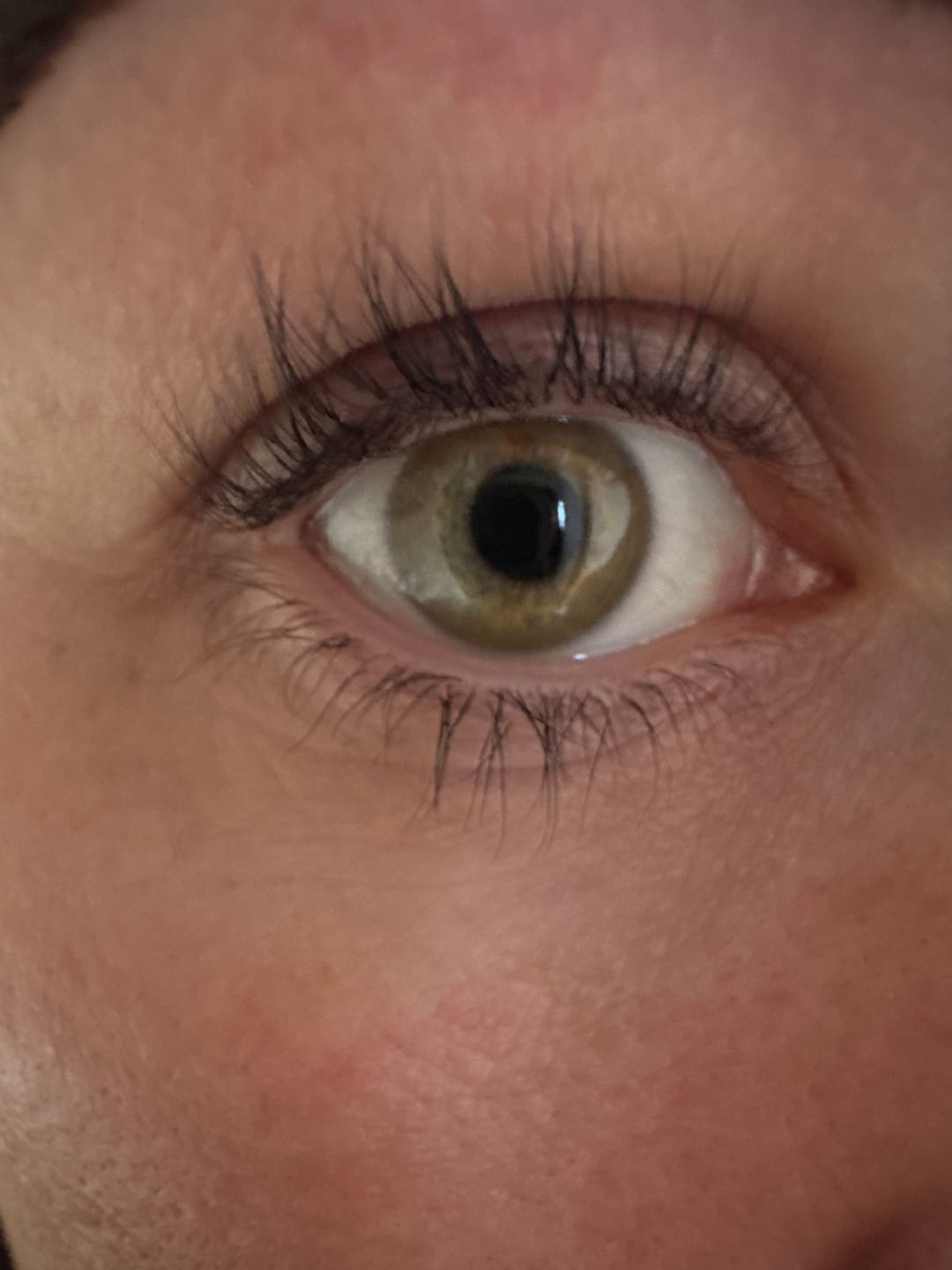 Customer photo review of Lash Serum | INTENSE