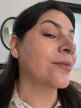 Customer photo review of Calcium Multi Balm
