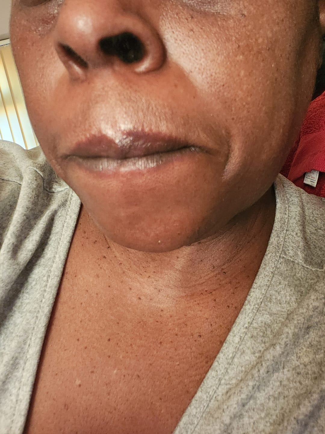 Customer photo review of Activating Body Scrub.