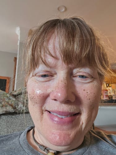 Customer photo review of Gold Glitter Freckles Makeup Patches