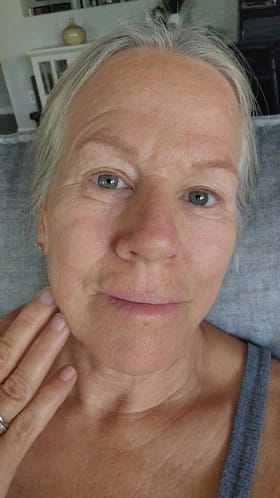 Customer photo review of Calcium Multi Balm