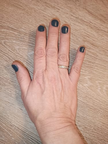 Customer photo review of Verzending Verzekering