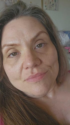 Customer photo review of Calcium Multi Balm