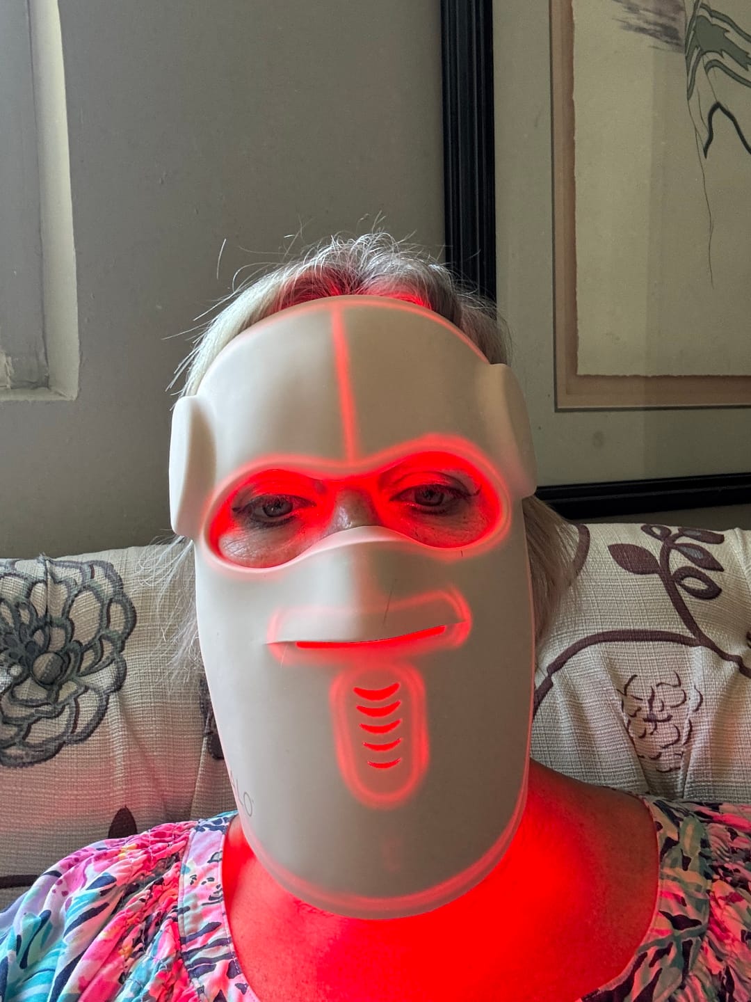 Customer photo review of Hatch Halo™ Dermatologist Grade 3-in-1 Light Therapy Mask