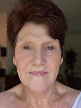 Customer photo review of Calcium Multi Balm