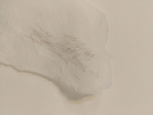 Customer photo review of Signature Series Hair Removal Wax