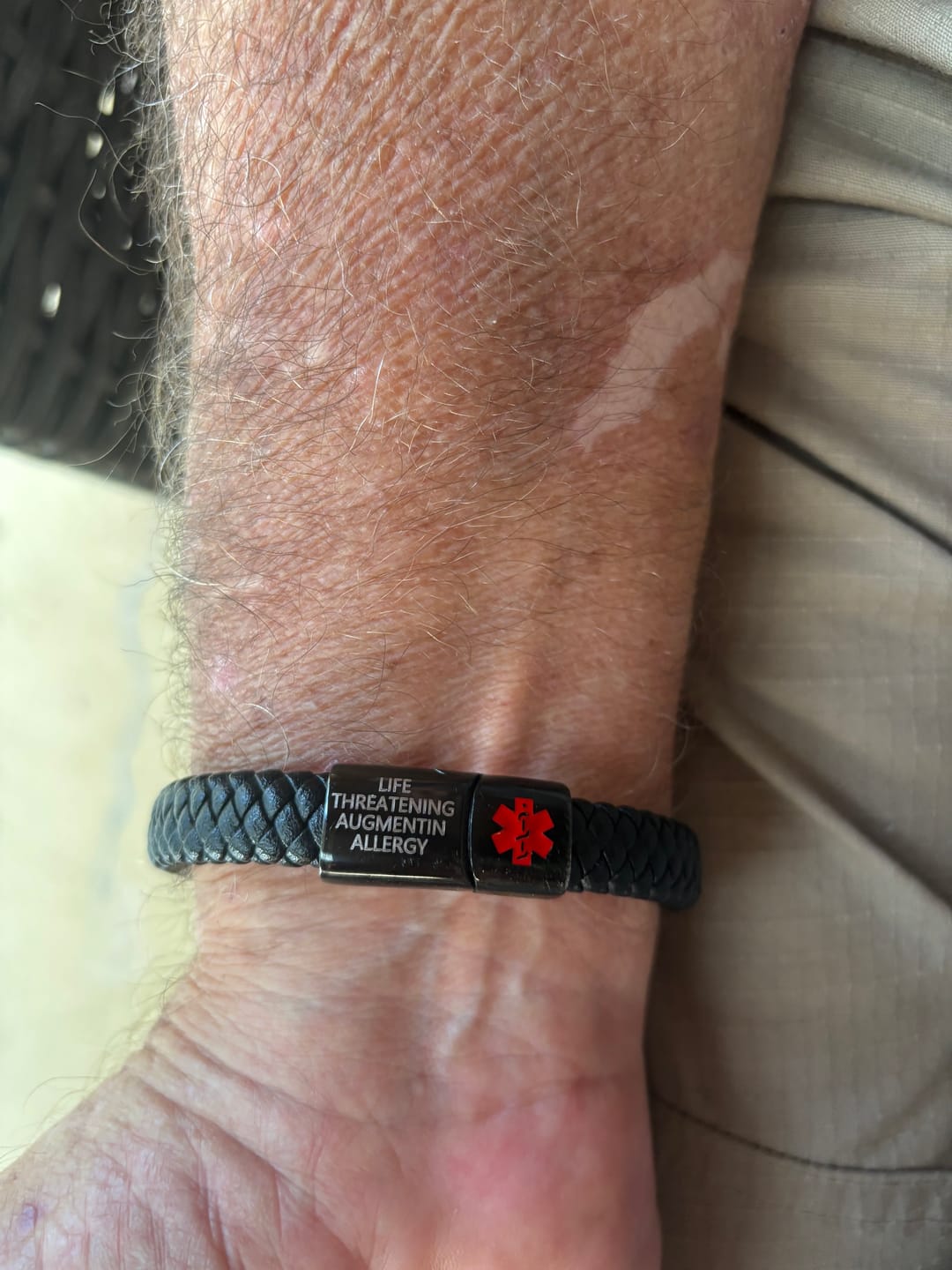 Customer photo review of Red-Alert Leather Medical ID Bracelet