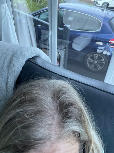 Customer photo review of VITAFOAM ™ Hair Growth Formula