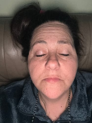 Close-up of a customer's face with eyes closed, showing their skin for a Grass Fed Tallow & Honey Balm review.