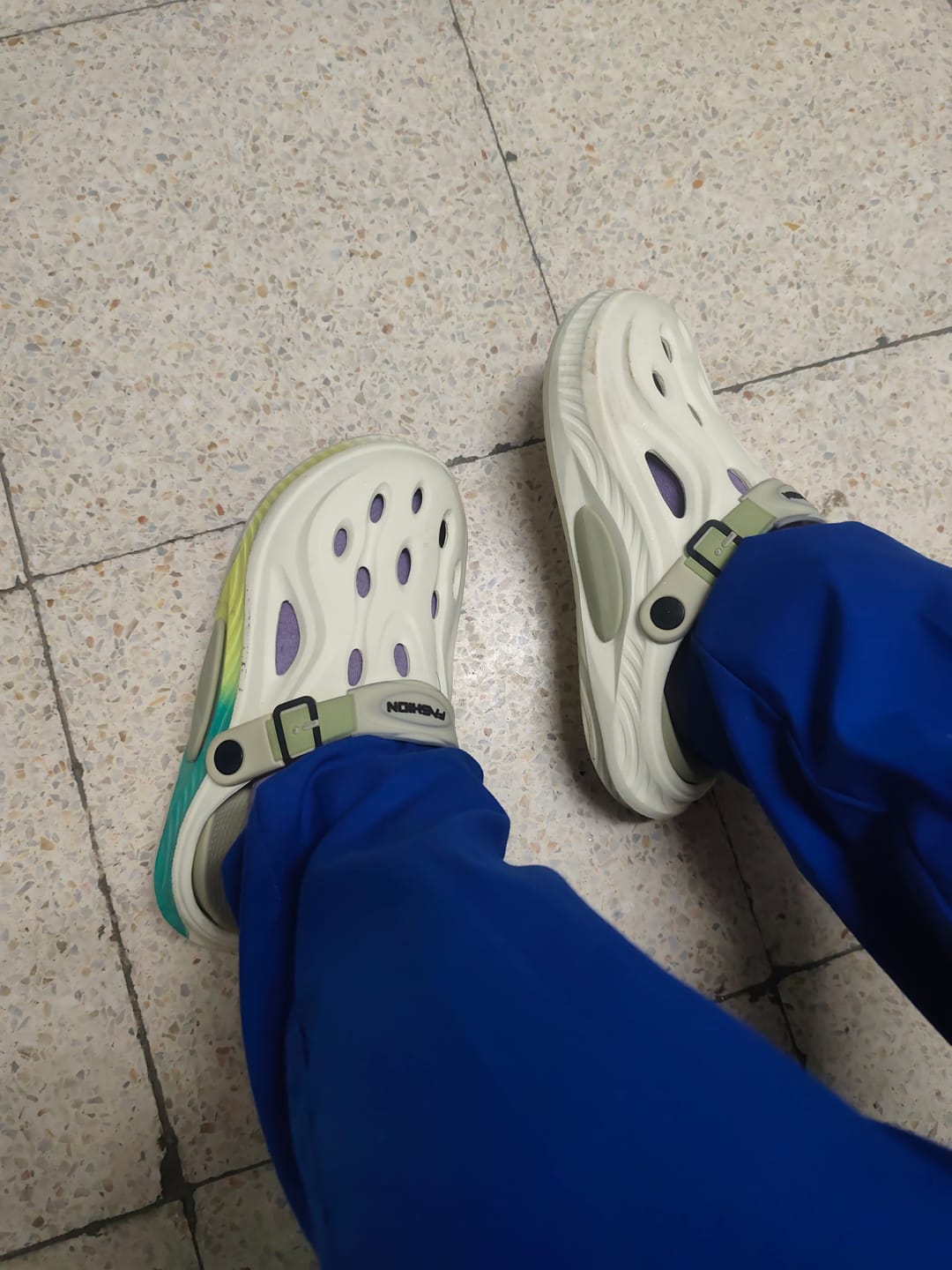 Customer photo review of Ortopedik Sandalet
