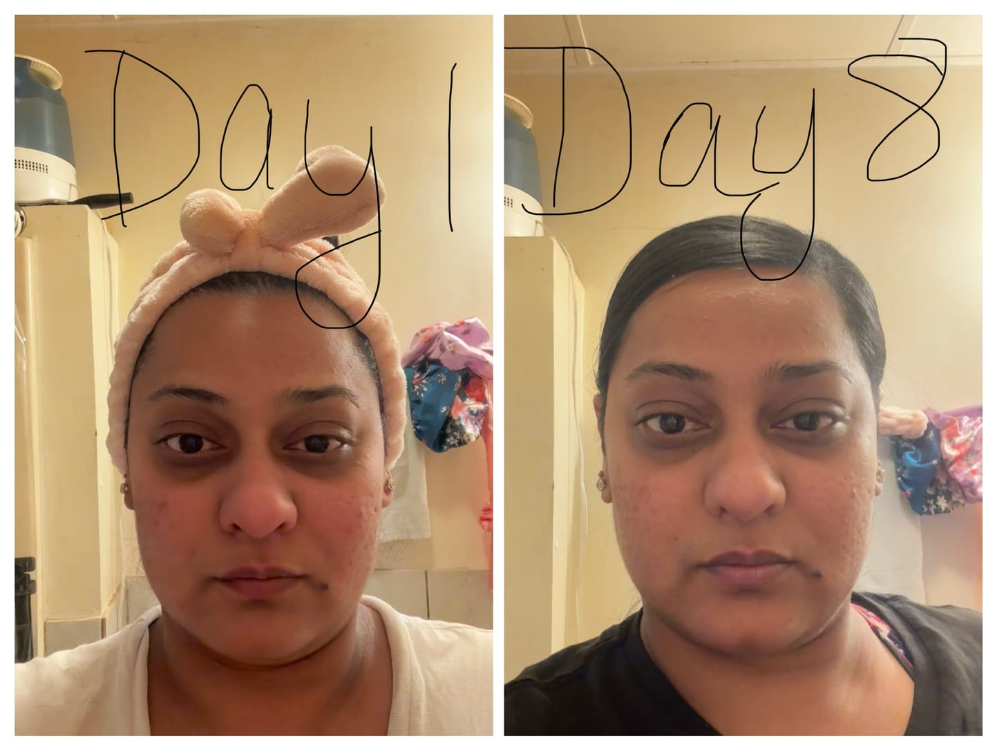 Customer photo review of Glass Skin Face Kit