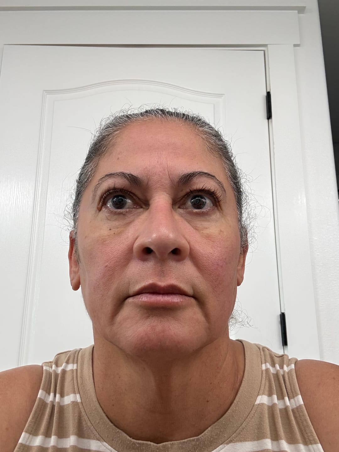 Customer photo review of INIA Microcurrent Sculpting Duo
