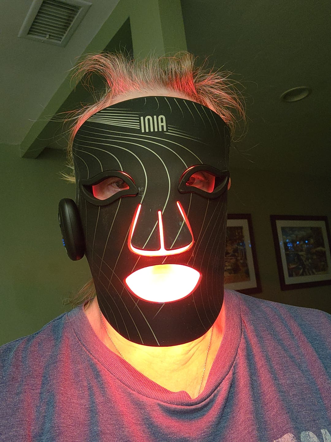 Customer photo review of INIA GLOW Wireless Red Light Therapy Mask