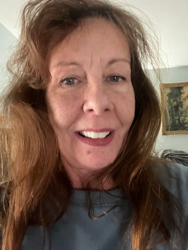 Customer smiling to show her new white teeth with Pop On Veneers.