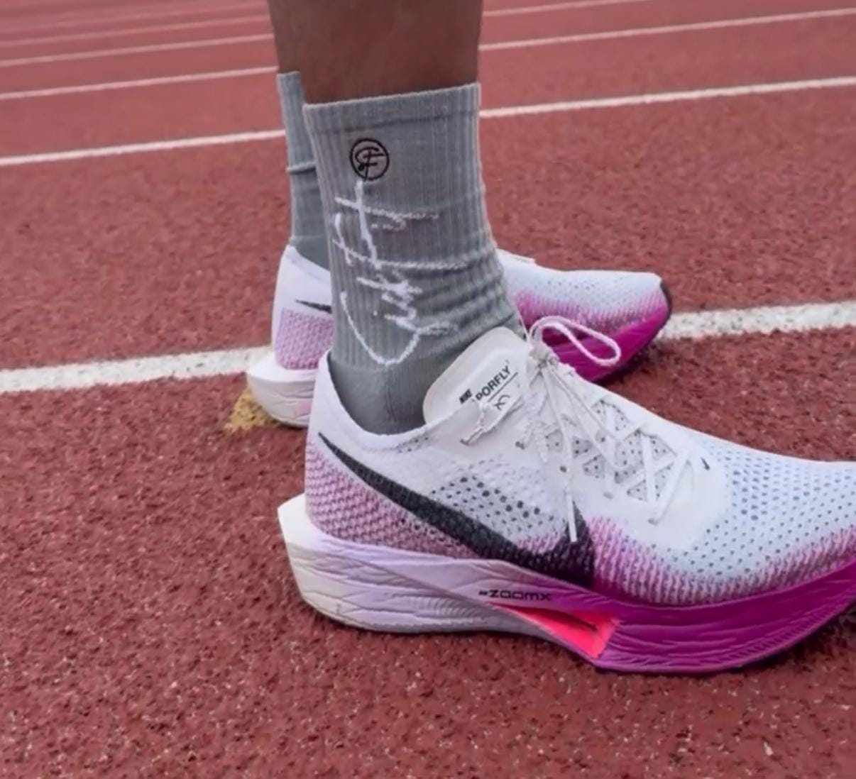 Customer photo review of SickFit Classic Compression Socks – 6 Pack Crew Performance Set