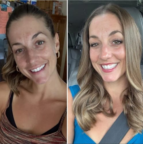 Customer photo review of LUMORA PDRN Renewal Infusion Mask 34ml x 4 sheets
