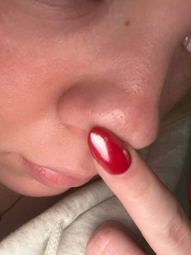 Customer photo review of Deep Cleansing & Aftercare System