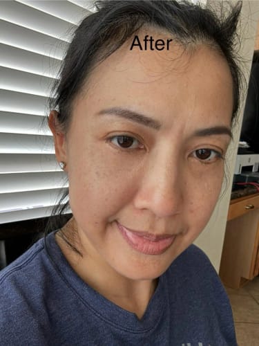 Customer photo review of Lumora™ GHK-Cu Copper Peptide Face Serum