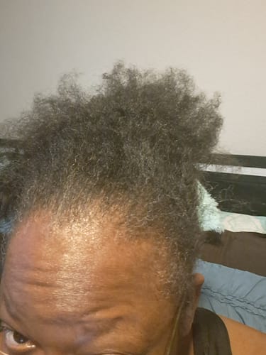 Close-up of a reviewer's hairline and dark coily hair, showing new growth after using the Nurture & Grow hair bundle.