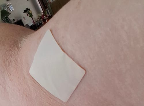 Customer photo review of mussage 8 Hour Sleep Patch