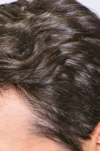 Customer photo review of Seb Natural Calming Serum