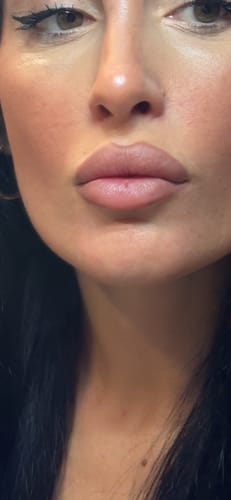 Customer photo review of Lip Contour