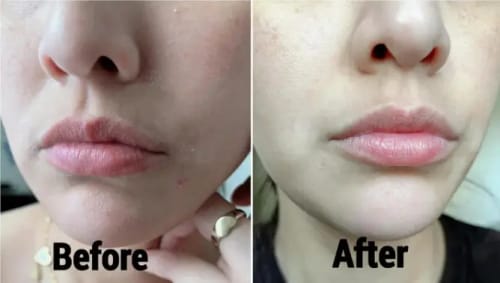 Customer photo review of Lumora™ GHK-Cu Copper Peptide Face Serum