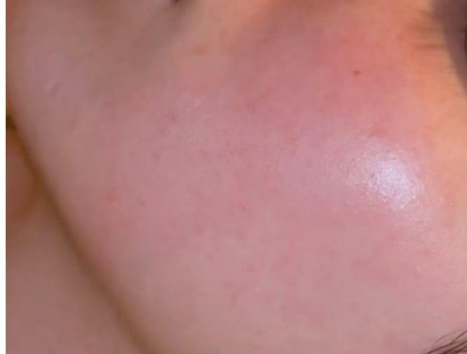 Customer photo review of Sleek Skin Serum 30ml