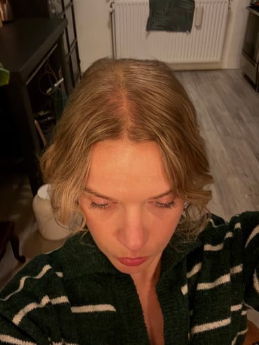 Customer photo review of VITAFOAM ™ Hair Growth Formula