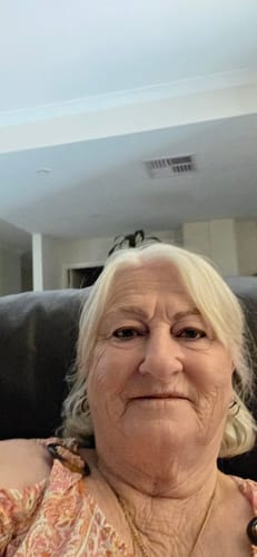 A reviewer's close-up photo showing their renewed skin after using the Sea Buckthorn Serum.