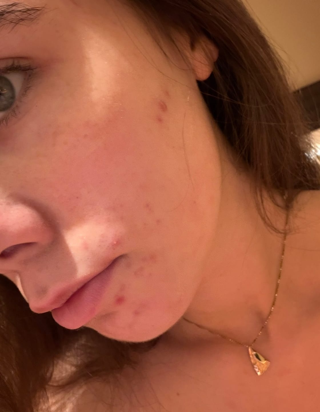 Customer photo review of TORRIDEN DIVE-IN Soothing Cream