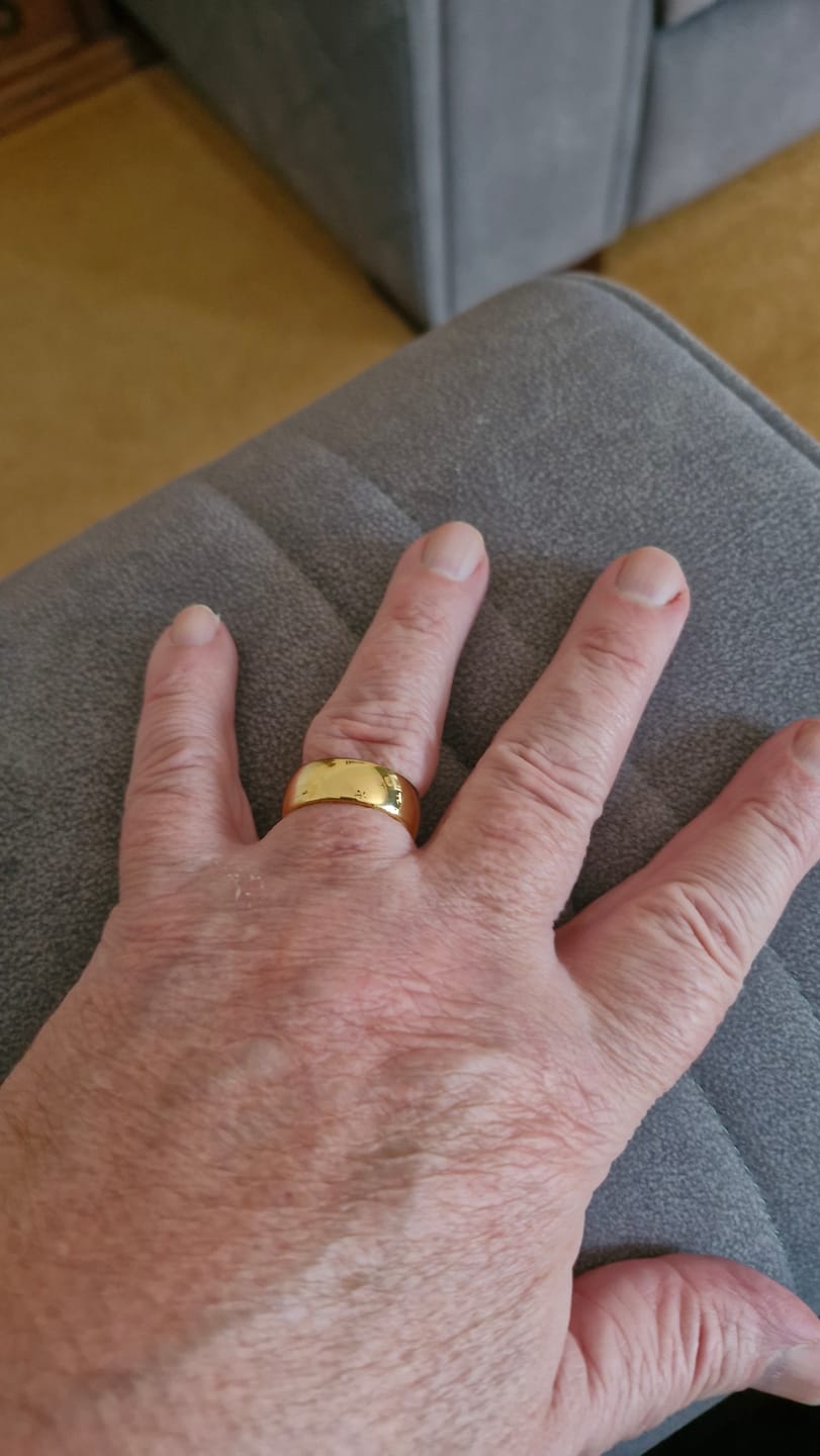 Customer photo review of Gold 8mm Wonder Ring