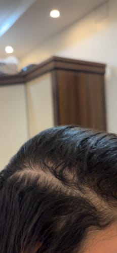 Customer photo review of Hair Loss Prevention Kit