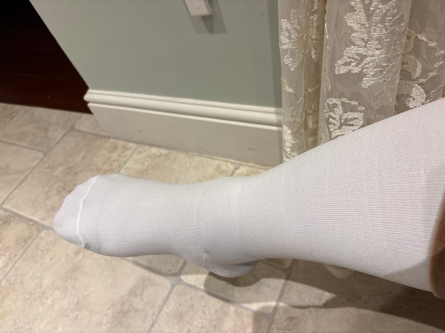 Customer photo review of The Step by Step Guide To Transforming Your Leg Health
